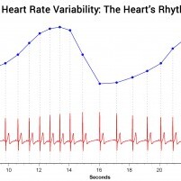 HMI-Blog-Heart-Rate-Variability-The-Hearts-Rhythm-300x201.jpg